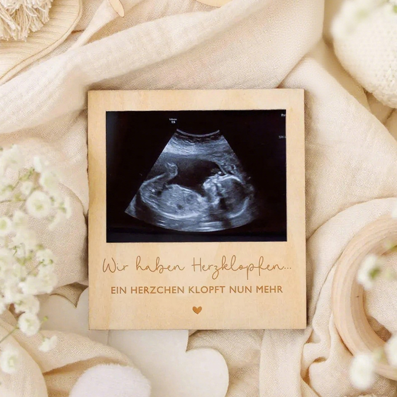 Ultrasound Pregnancy Announcem - Photo Booth Frame avaliação e preço