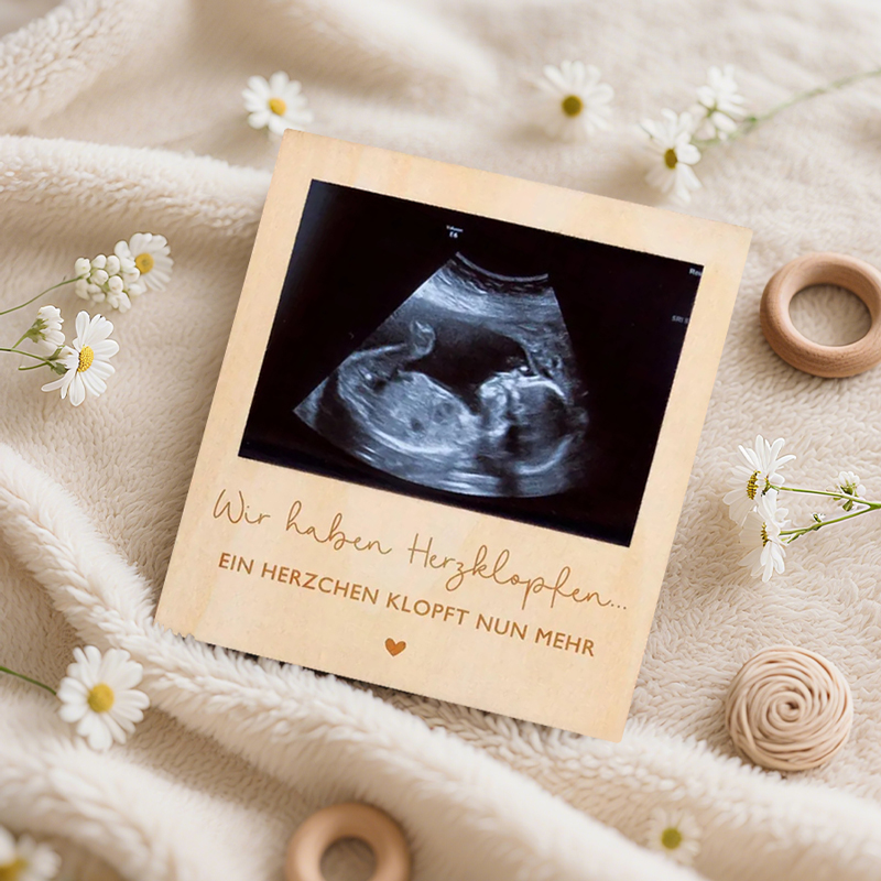 Ultrasound Pregnancy Announcem - Photo Booth Frame avaliação e preço